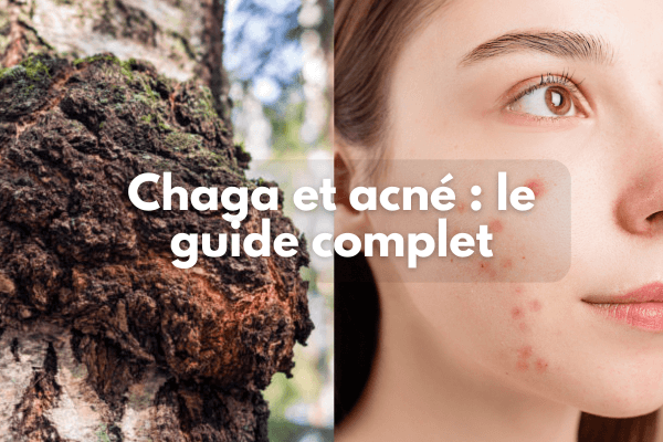 Chaga et acné